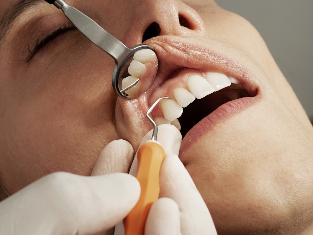 Teeth whitening